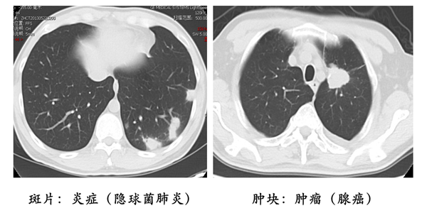 医学影像病变分析方法