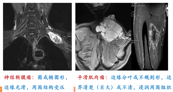 医学影像病变分析方法